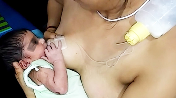 Induced Lactation, Breastfeeding Without Birthing